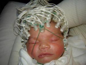 brain activity in baby