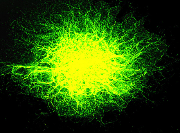 To study how nerve cells respond to injuries in their branches, Washington University researcher Valeria Cavalli grows them in “spots” like the one shown above. Cavalli recently identified a chain reaction that enables repair of these branches when they are cut. Credit Yongcheol Cho/Washington University at St. Louis. 