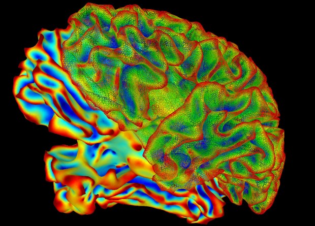 A multi-colored image of a brain for imaging research. Researchers from Northwestern University released a study showing that the memories can adapt. Scientists used a functional MRI and eye tracking as part of their research.