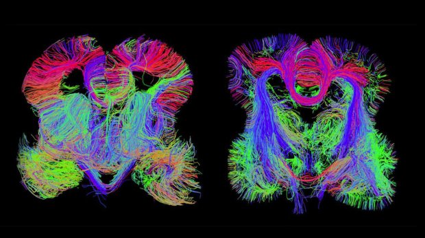 Images of the developing fetal brain show connections among brain regions.  Allen Institute for Brain Science and Bruce Fischl, Massachusetts General Hospital
