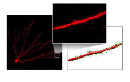 Granule cells connect with other cells via long projections (dendrites). The actual junctions (synapses) are located on thorn-like protuberances called “spines”. Spines are shown in green in the computer reconstruction Credit DZNE/Michaela Müller.