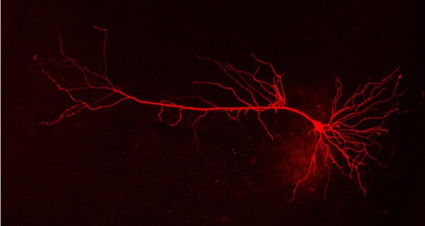 Nerve cells communicate with each other via intricate projections. In brain diseases such as Alzheimer’s and Parkinson’s these extensions atrophy, thereby causing connectivity problems. Credit DZNE/Detlef Friedrichs.