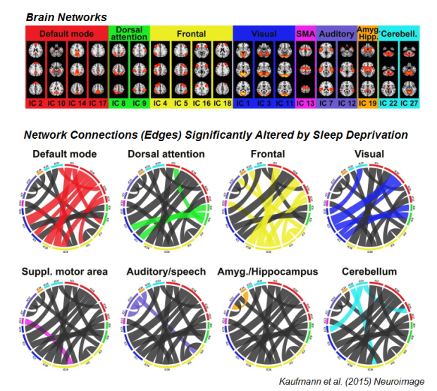kaufmann_sleep_fmri