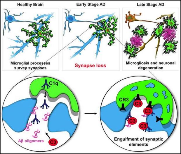 alzheimers-synapse-loss