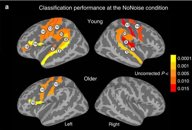hearing-loss-frontal-cortex-neurosciencenews