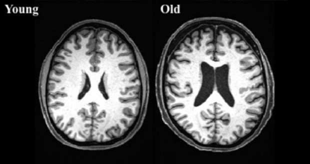 aging-sharpness-neuroscinencew.jpg