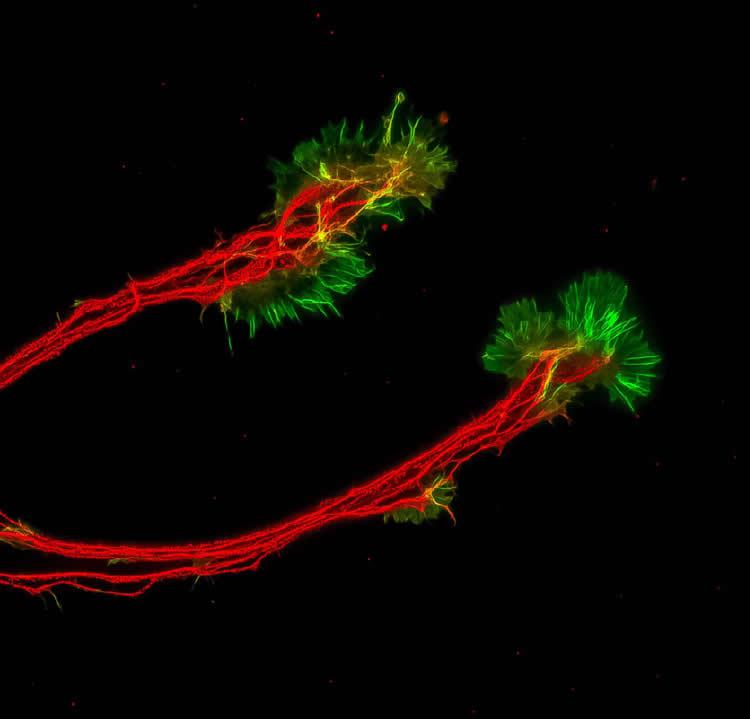 mini-retina-eye-brain-neurosciencenews