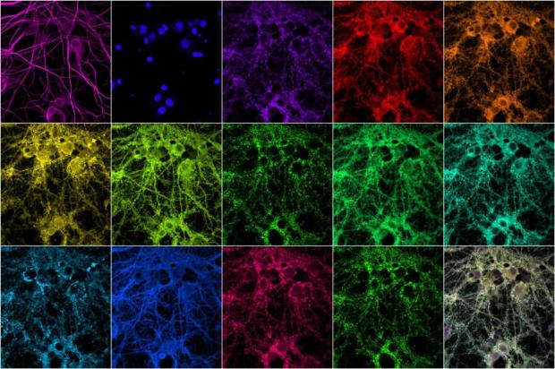 protein-synapse-imaging-neurosciencenews